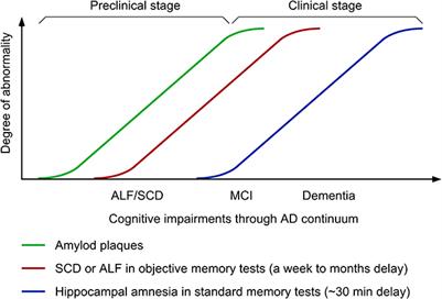 Accelerated long-term forgetting: A sensitive paradigm for detecting subtle cognitive impairment and evaluating BACE1 inhibitor efficacy in preclinical Alzheimer's disease